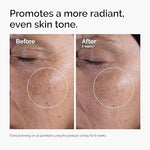 The Ordinary Glycolic Acid 7% Exfoliating Toner, Brightening and Smoothing Daily Toner for More Even-Looking Skin Tone