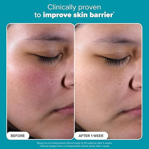 Paula's Choice SKIN PERFECTING 2% BHA Liquid Salicylic Acid Exfoliant-Facial Exfoliant for Enlarged Pores, Wrinkles & Fine Lines, Suitable for Blackhead-Prone Skin, Fragrance-Free